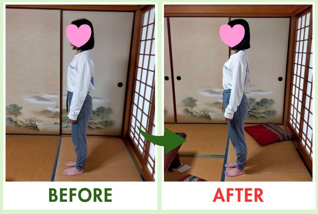 姿勢改善 ビフォーアフター